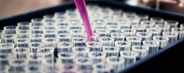 A micropipette is used to fill a 96-well plate in a clinical laboratory